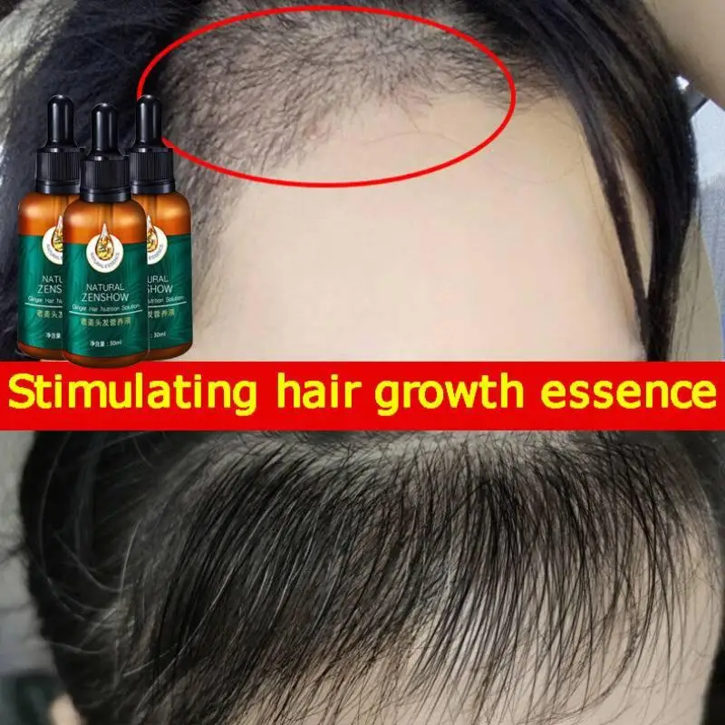 Ginger Hair Growth Essential O - Hair Care Herbal Products 评论和价格