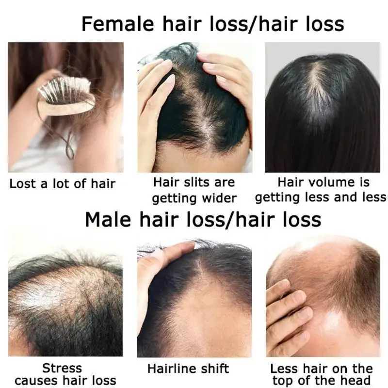 Ginger Hair Growth Essential O - Hair Care Herbal Products 评论和价格