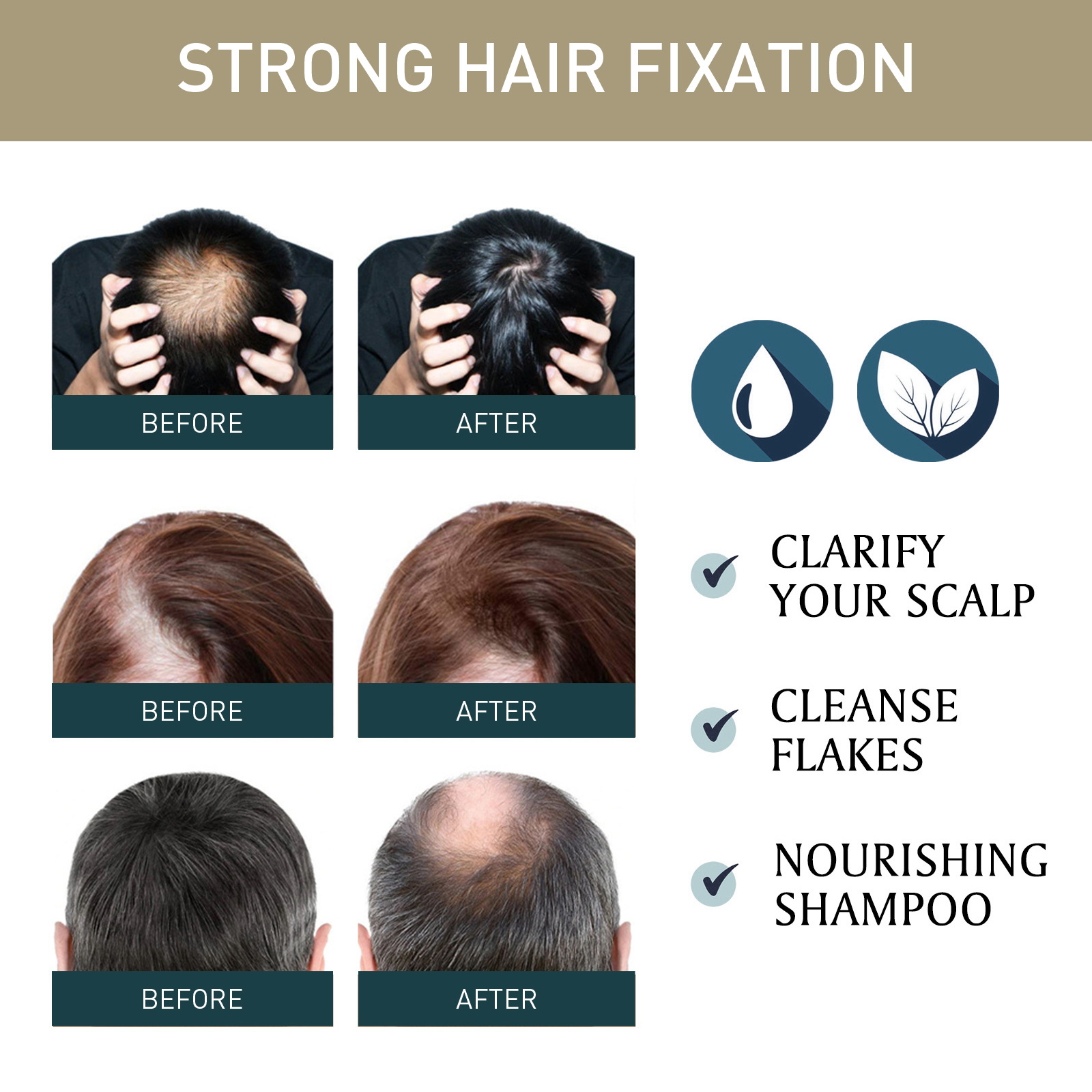 2pcsx100ml Hair Growth Shampoo - Hair Care Natural Ingredients 评论和价格