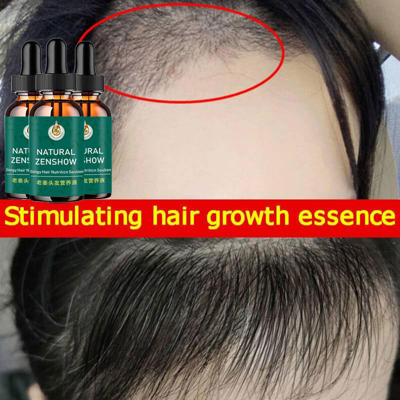 Ginger Hair Growth Essential O - Hair Care Herbal Products 评论和价格