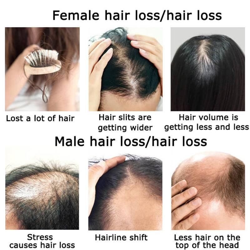 Ginger Hair Growth Essential O - Hair Care Herbal Products 评论和价格