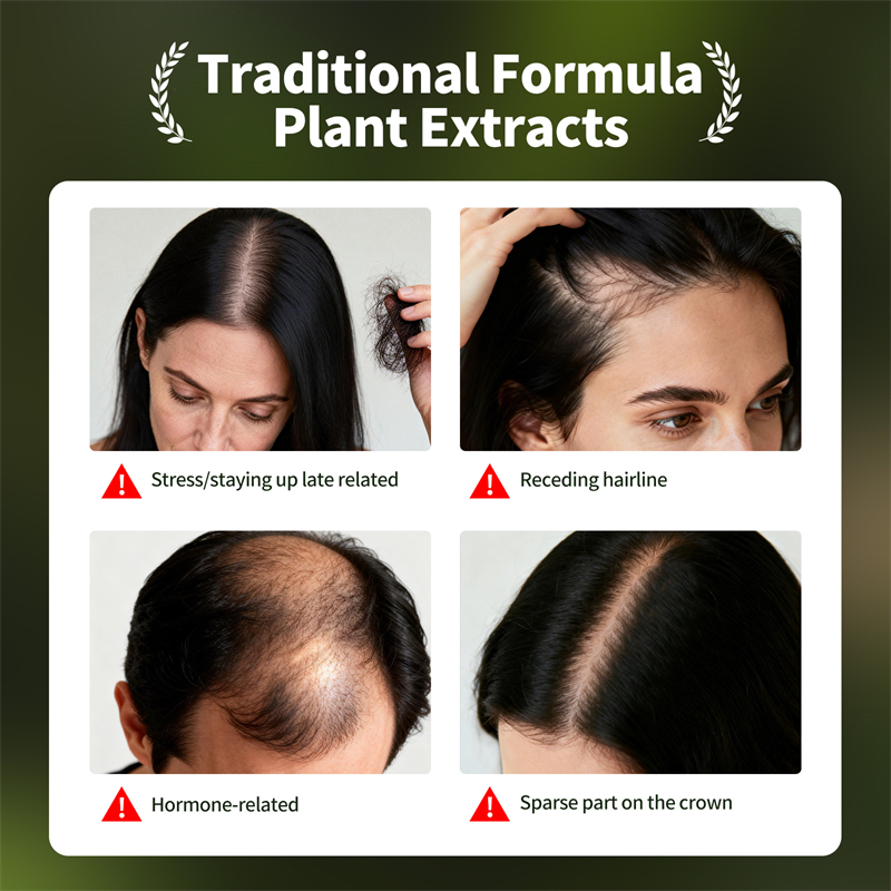 Natural Hair Growth Set Usman  - Hair Care Herbal Products 评论和价格