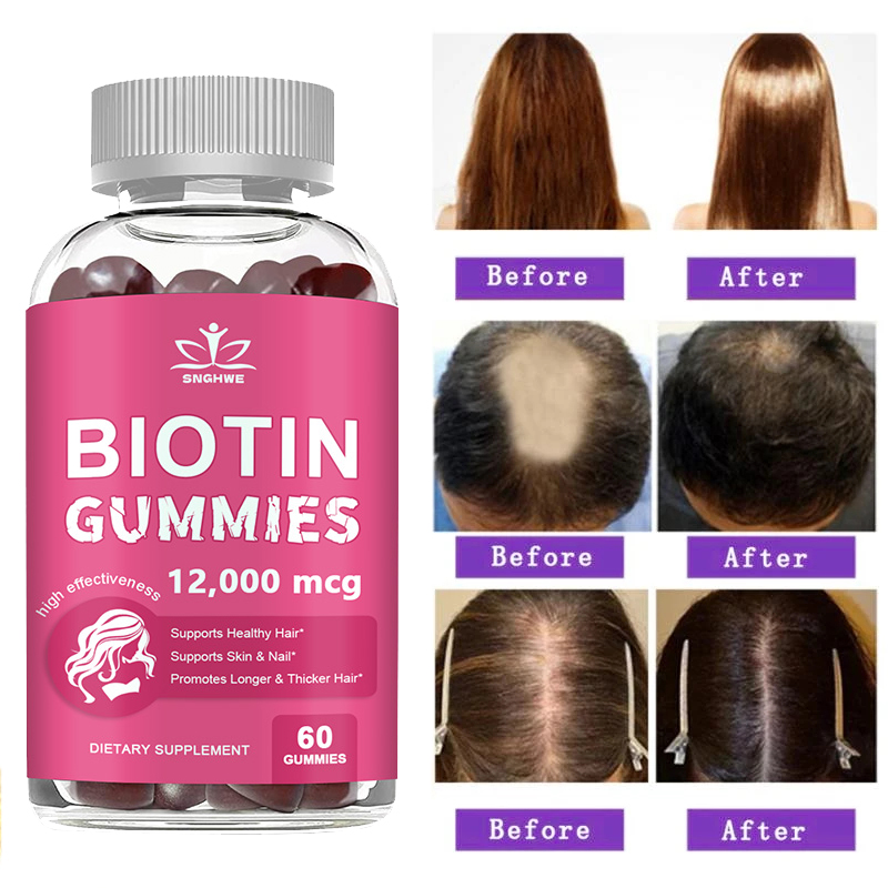 Collagen Gummies Biotin Gummie - Hair Care Gummies 评论和价格