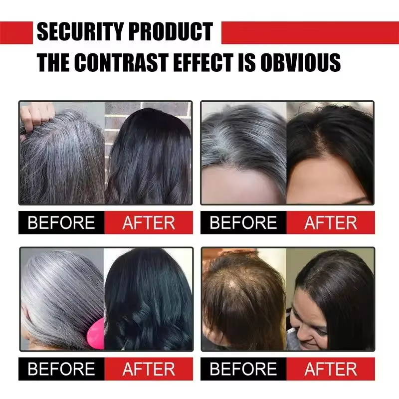 Herbal Anti-grey Hair Treatmen - Hair Care Herbal Products 评论和价格