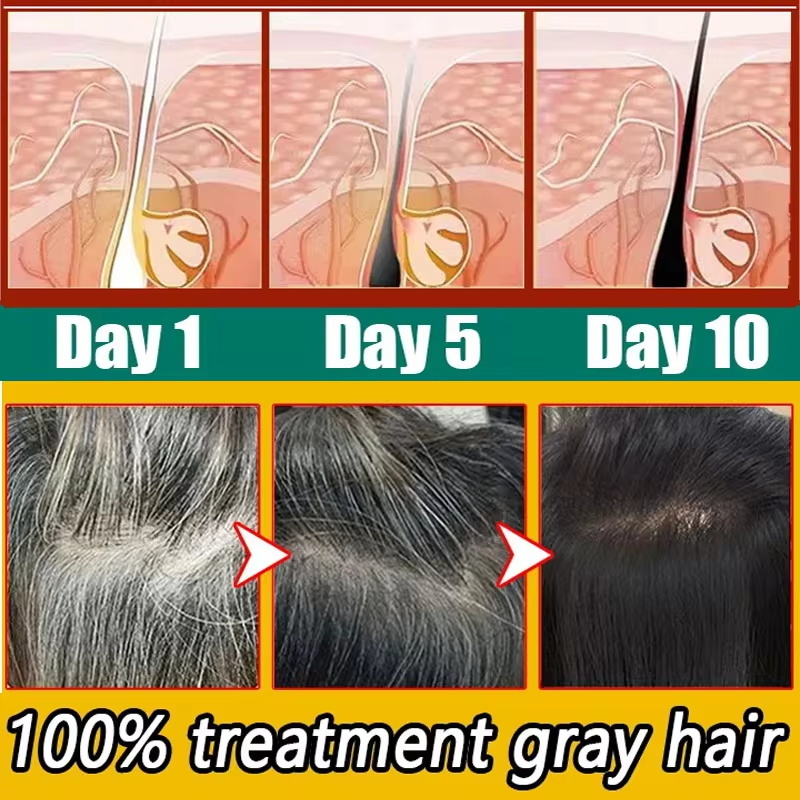 Herbal Anti-grey Hair Treatmen - Hair Care Herbal Products 评论和价格