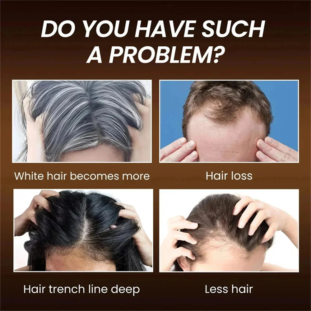 Herbal Anti-grey Hair Treatmen - Hair Care Herbal Products 评论和价格